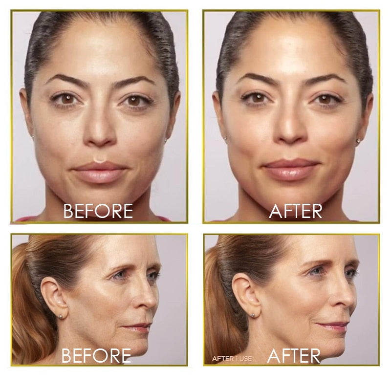 Casano Flawless Dermaplane Glow – Facial Hair Removal & Exfoliator | Casano